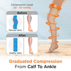 VISSCO MEDICAL COMPRESSION - CLASS 2 THIGH LENGTH | MILD SUPPORT (BEIGE)