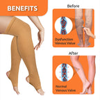 VISSCO VEIN VARICOSE STOCKINGS | PROVIDES LEG COMPRESSIONS TO IMPROVE BLOOD CIRCULATION & RELIEVES PAIN (BEIGE)
