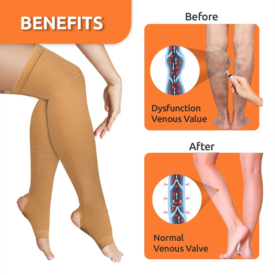 VISSCO VEIN VARICOSE STOCKINGS | PROVIDES LEG COMPRESSIONS TO IMPROVE BLOOD CIRCULATION & RELIEVES PAIN (BEIGE)